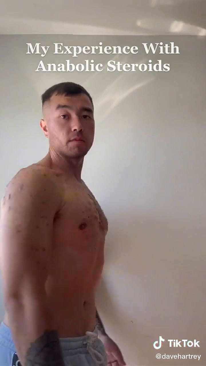 Dave Hartrey contó su experiencia al tomar esteroides en su perfil.