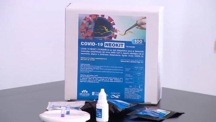 Coronavirus: Alberto Fernández anuncia un nuevo test para detectar ARN del Covid-19