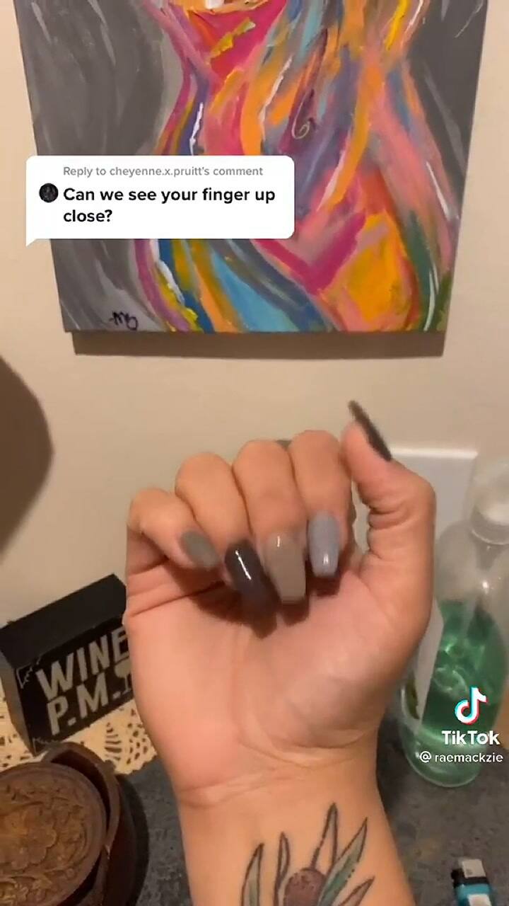 Le crece vello púbico en un dedo debido a un injerto de piel