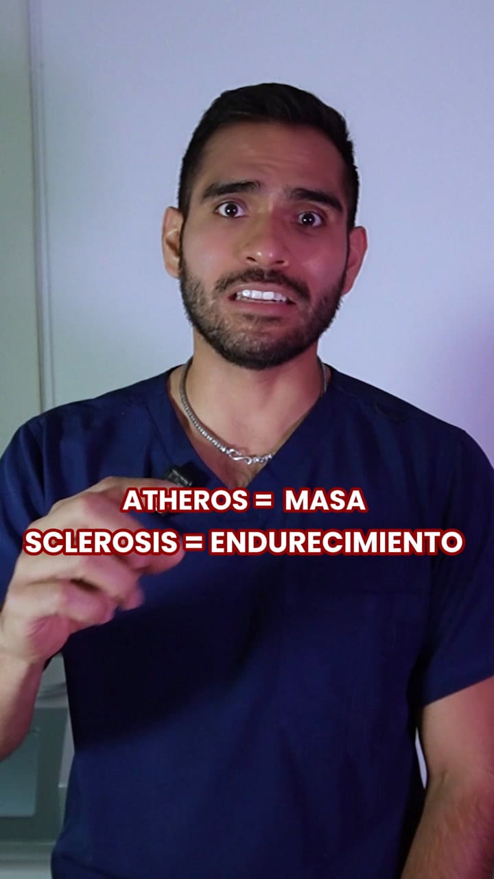 Cómo prevenir que se tapen las arterias