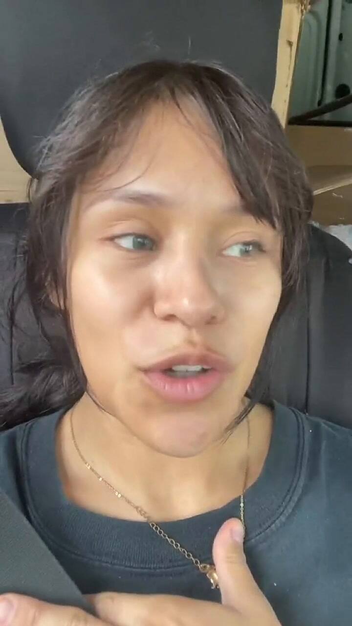 Novio infiel paga cirugía plástica a su novia para que lo perdone