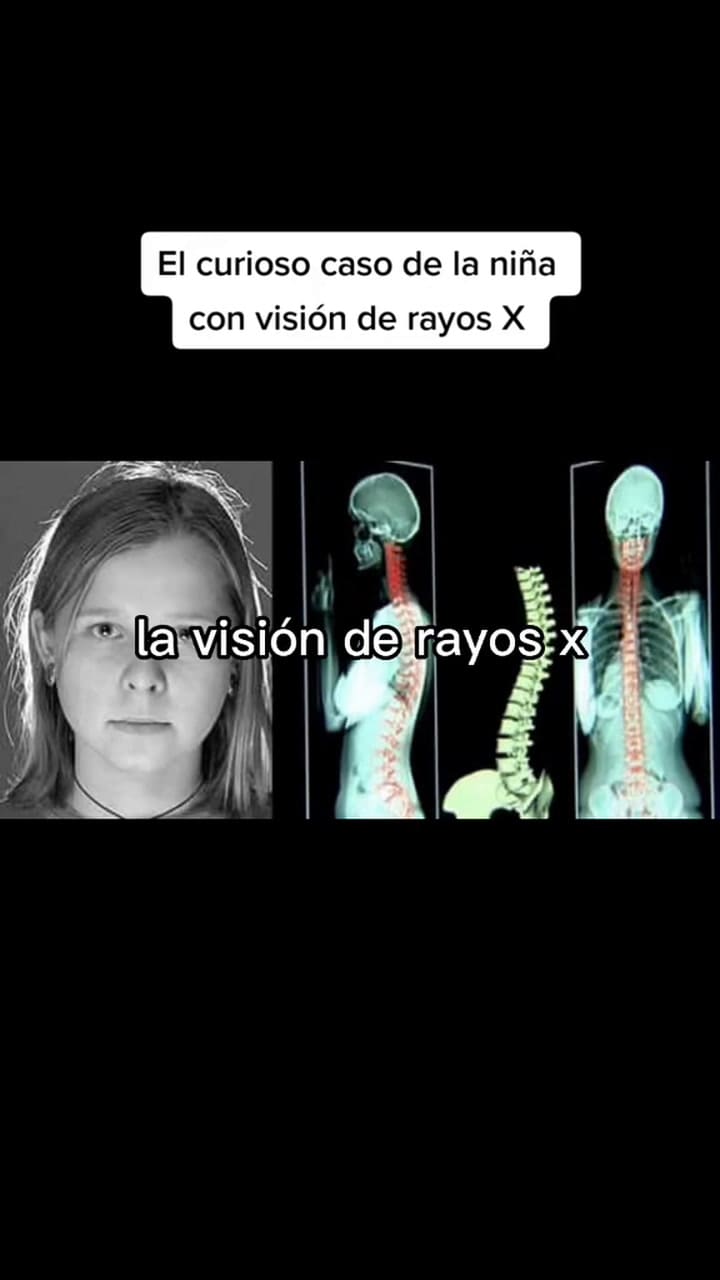 Natasha Demkina conoció su superpoder de rayos X a los 10 años de edad