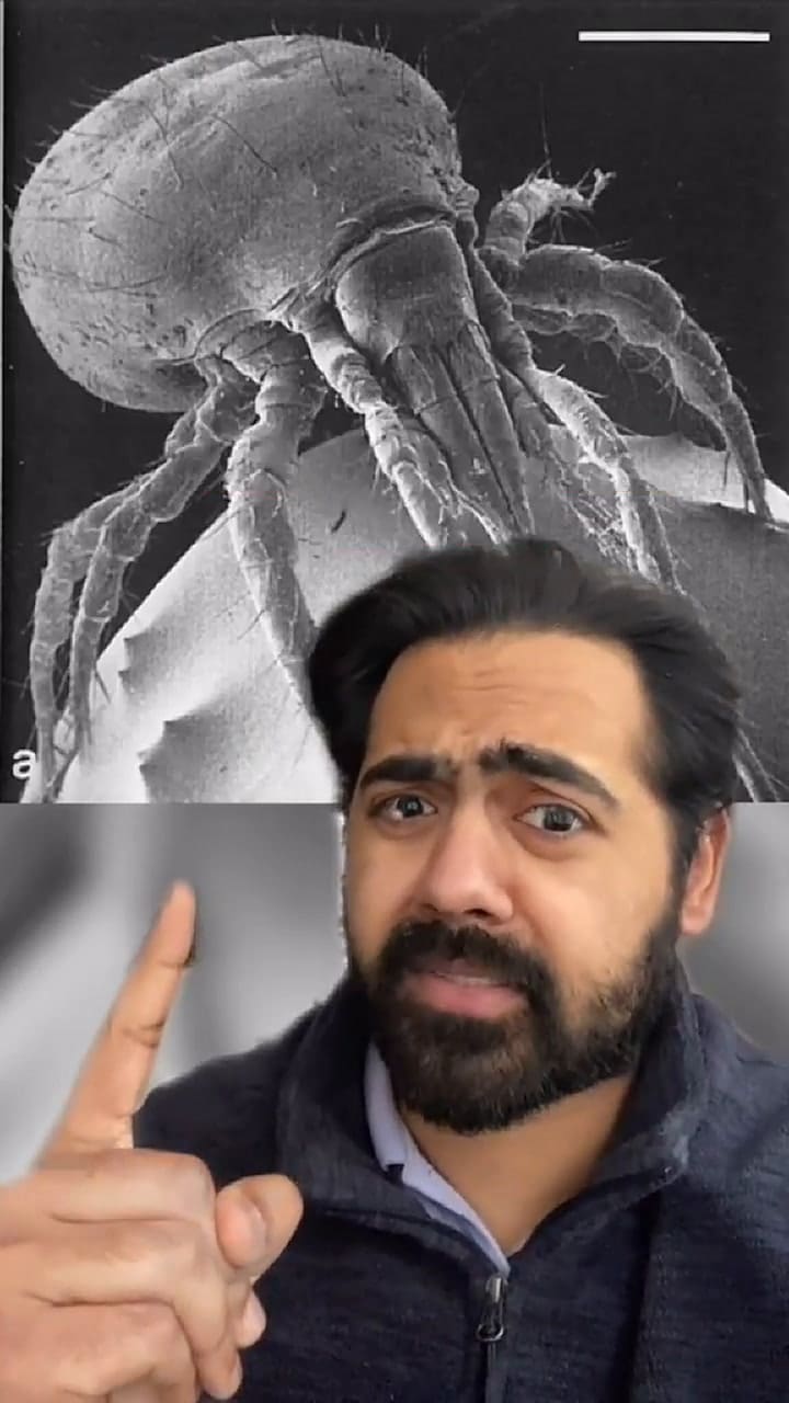 Un médico explica por qué es necesario cambiar las almohadas