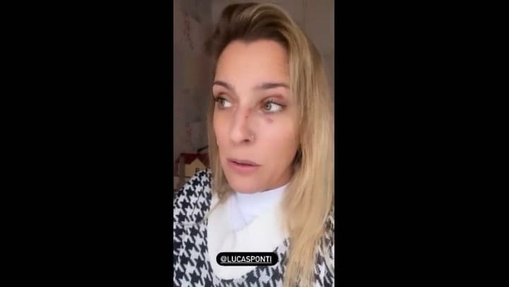 Dani La Chepi fue atacada por su gato