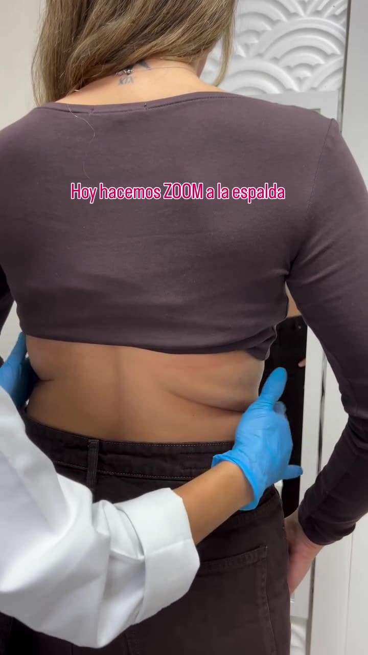 Ivana Icardi mostró su cambio físico tras una cirugía estética