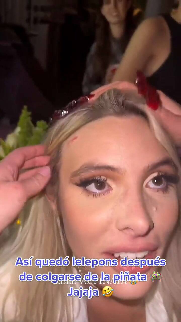 Lele Pons terminó con heridas en las rodillas y en el rostro luego de su gran fiesta