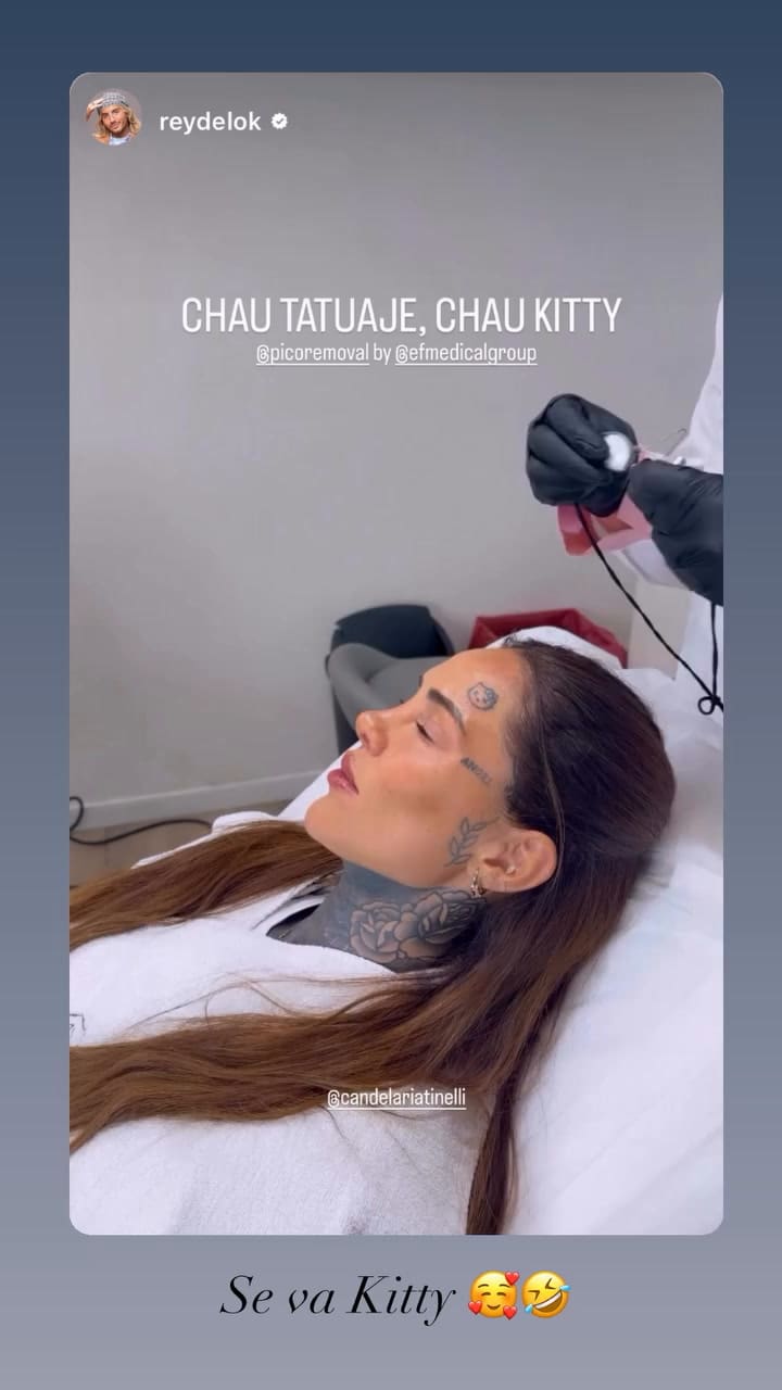 El cambio de Cande Tinelli: empezó a despedirse de uno de sus tatuajes más icónicos