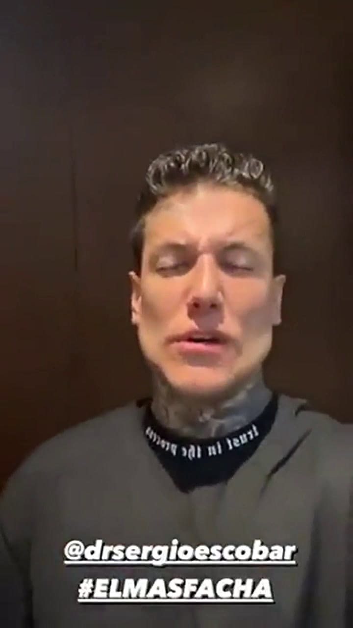 Alex Caniggia mostró su rostro luego de un retoque estético.