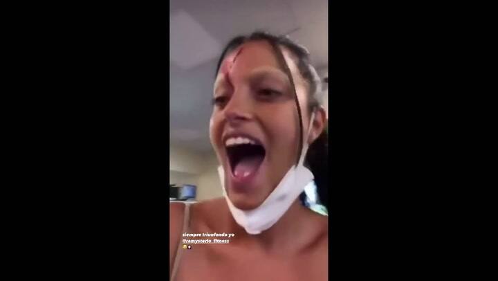 El sangriento accidente de Oriana Sabatini