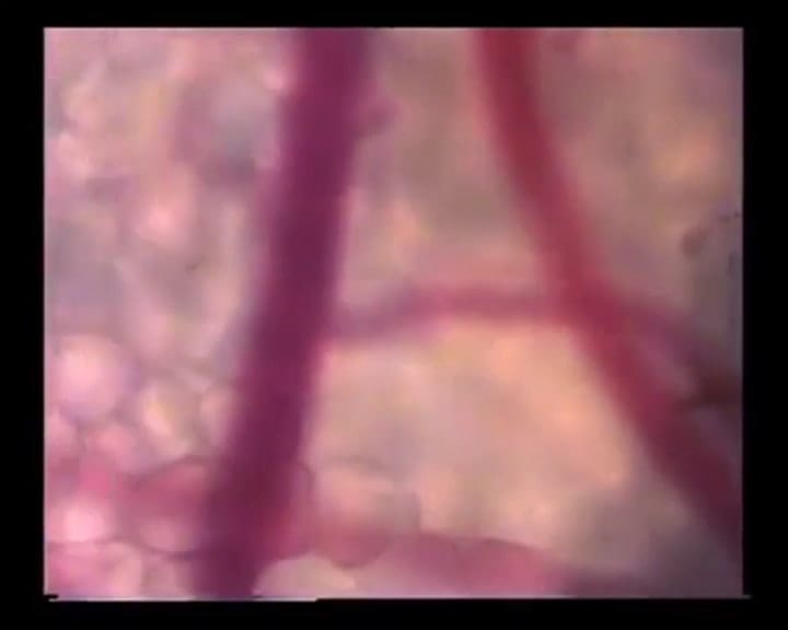 Microscopio: Un mosquito buscando un vaso sanguíneo - Fuente: YouTube