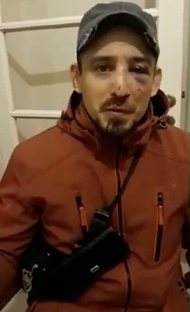 Denuncia que la policía lo golpeó cuando paseaba a su perro