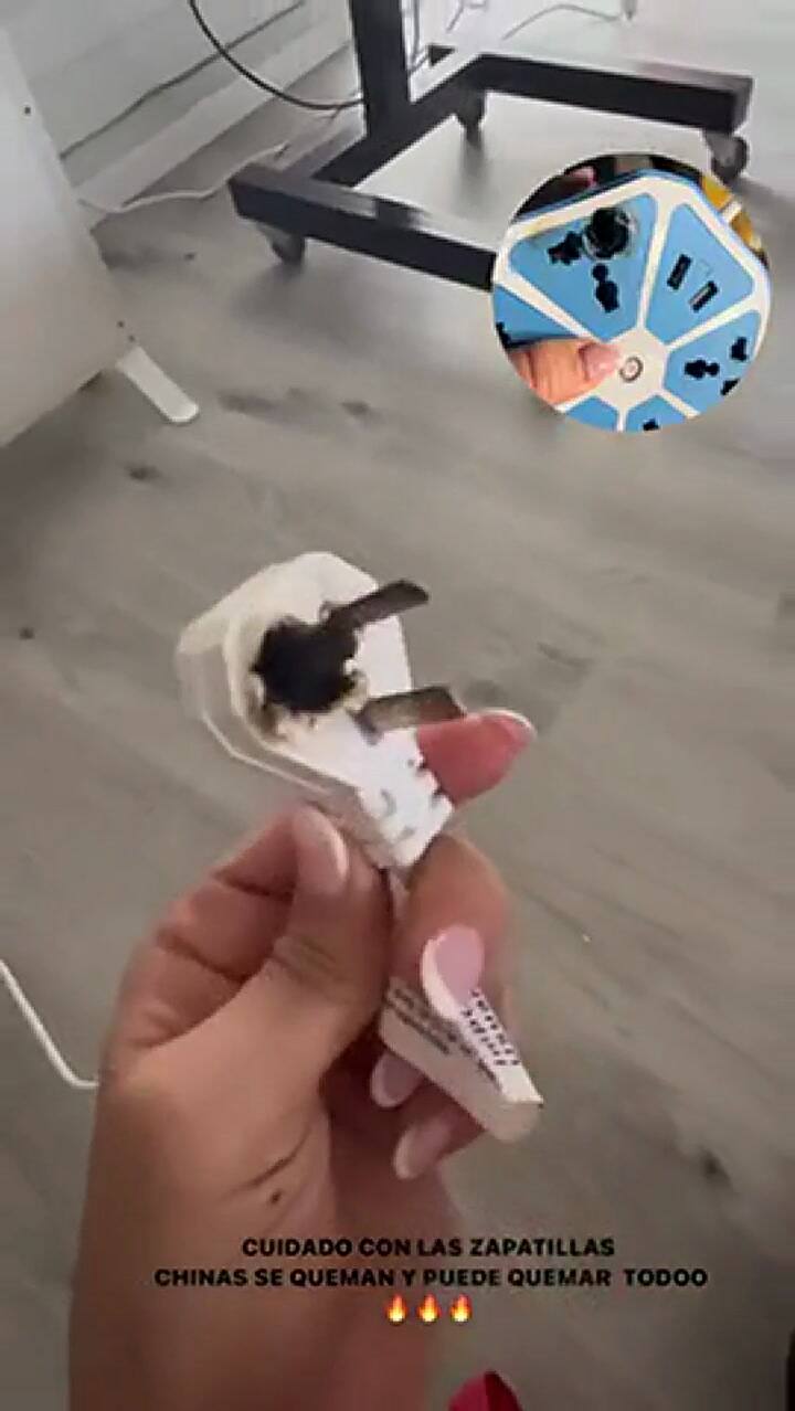 Flor Vigna sufrió un accidente doméstico y realizó una advertencia a sus fans