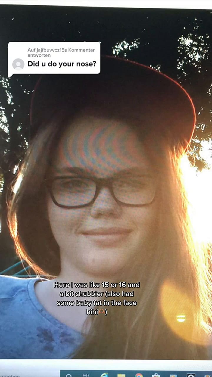 Tiktok aclaró si se hizo cirugías