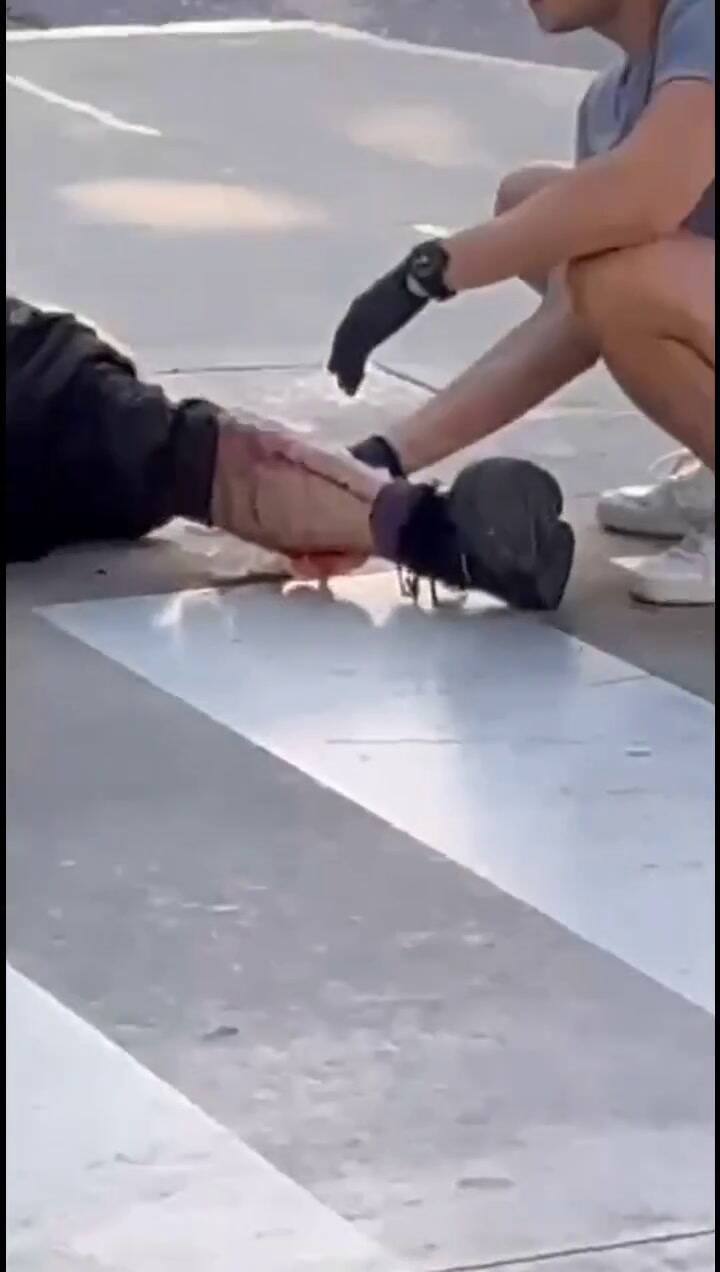 Motociclista baleado en un robo en Lomas de Zamora