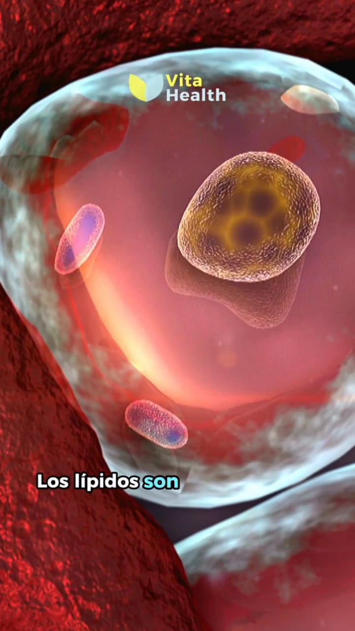 5 síntomas que presenta el cuerpo con colesterol alto