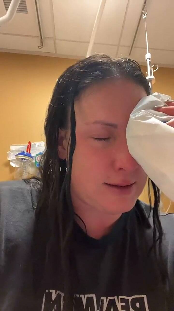 Confundió gotas para los ojos con pegamento y terminó en el hospital