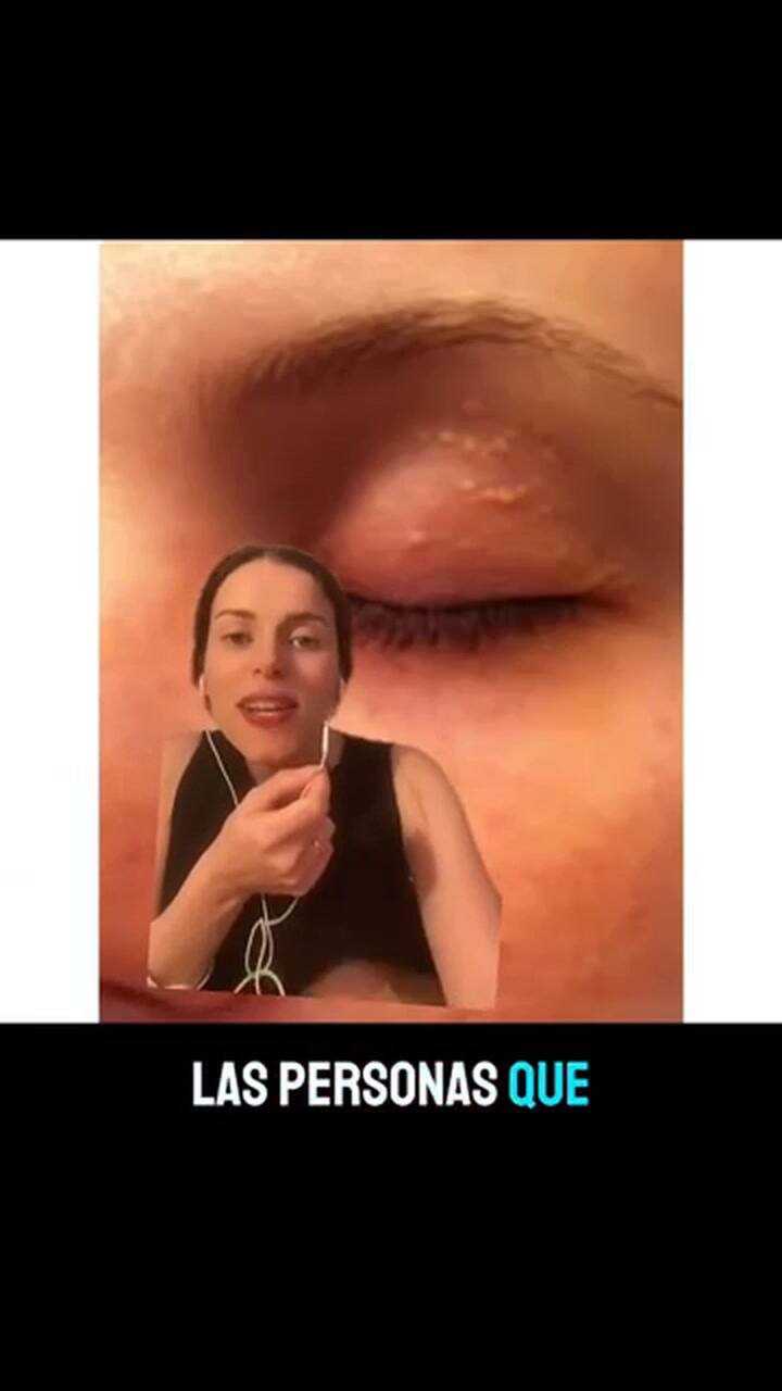 Cómo extirpar los quistes de millium