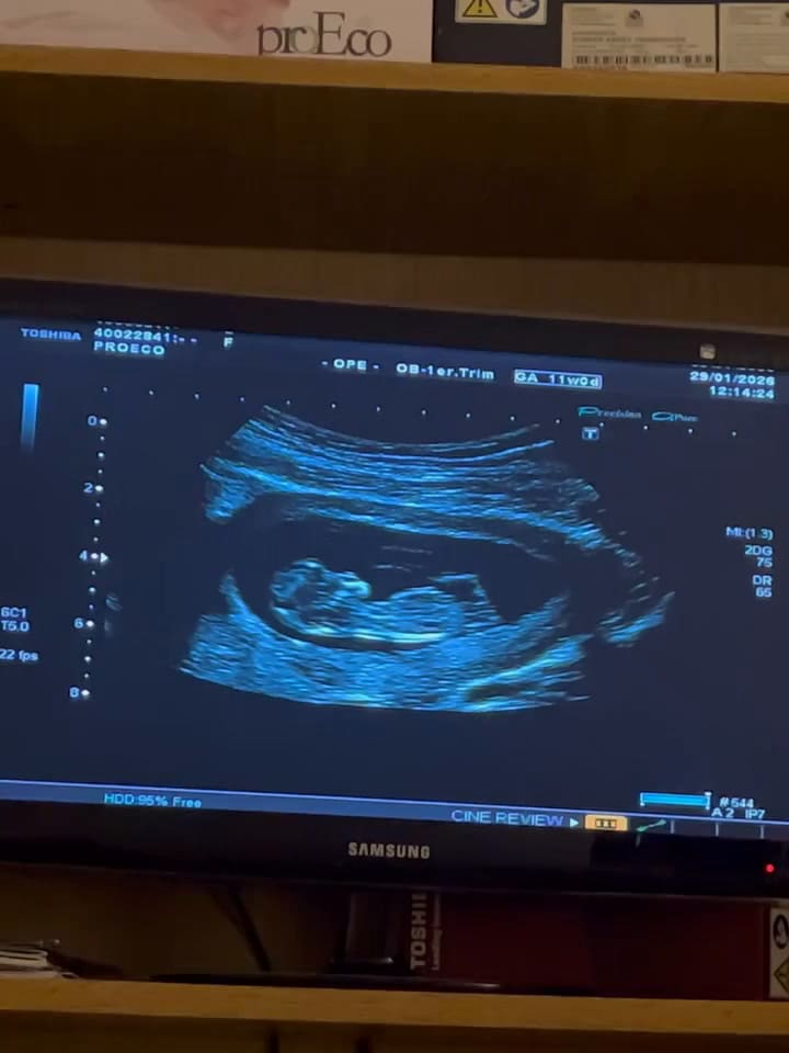 La ex Casi Ángeles Guadalupe Antón confirmó que será mamá