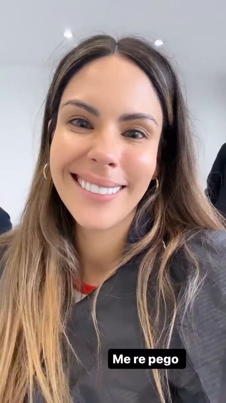 Barby Franco fue al dentista y mostró el impresionante efecto que tuvo la anestesia: “Me re pegó”