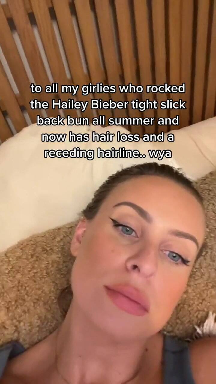 Esto le pasó por imitar el peinado de Hailey Bieber