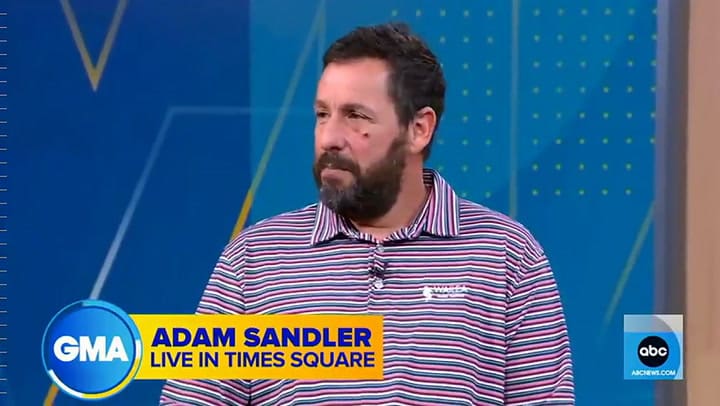 Adam Sandler apareció con un ojo morado y reveló el insólito motivo