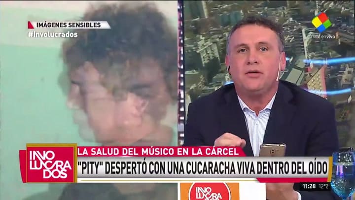 Cómo encontraron una cucaracha en el oído de Pity Álvarez. Fuente: América