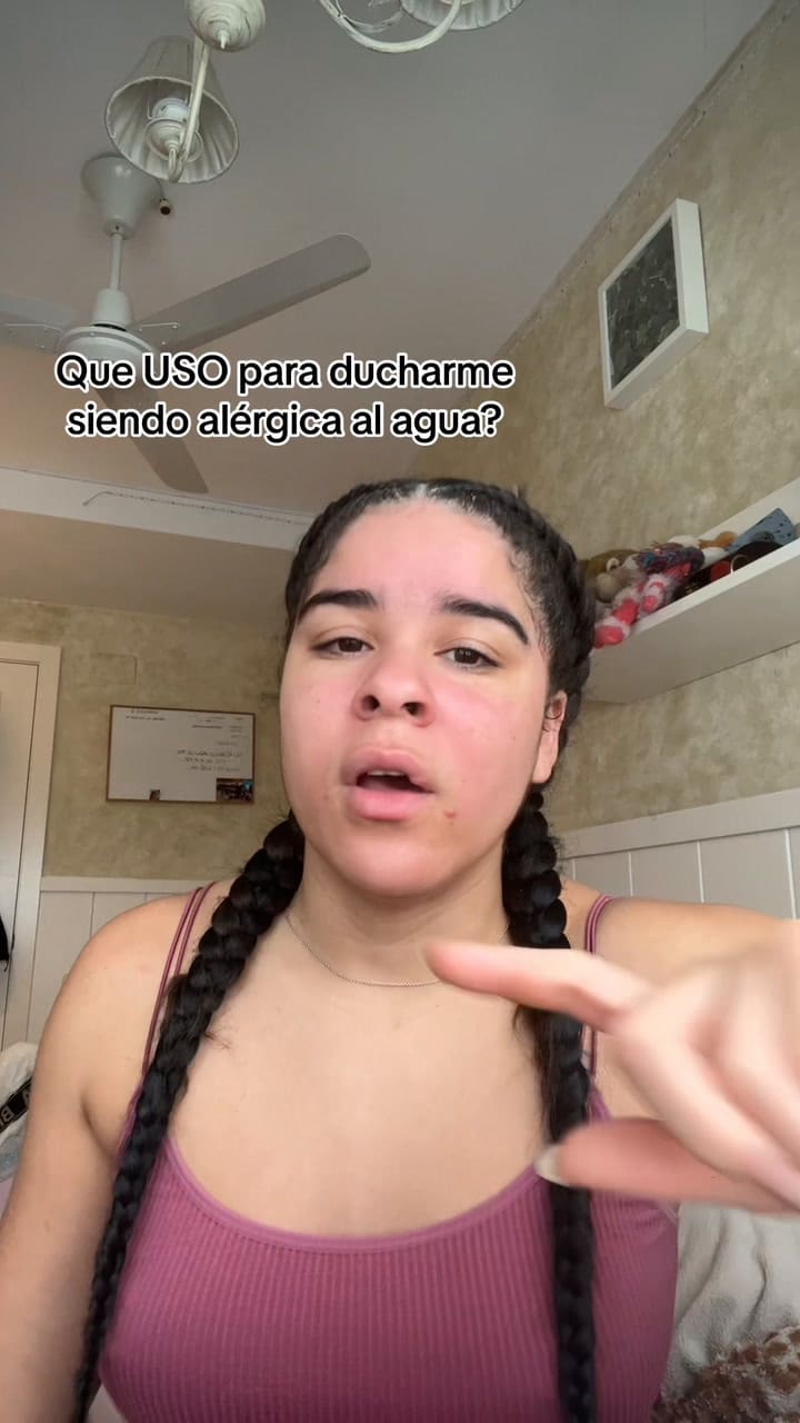 Una joven explica cómo logra bañarse siendo alergica al agua