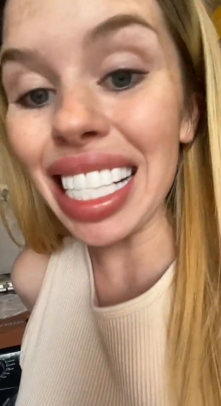 Mujer muestra en TikTok los terribles resultados de un diseño de sonrisa