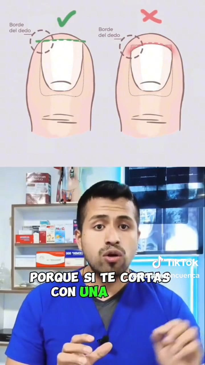 Cómo cortar las uñas adecuadamente