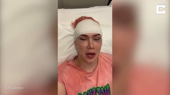 Gastó una fortuna en cirugía plástica para parecer coreano