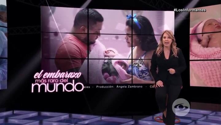 Itzamara, un milagro de vida que nació con su gemela adentro - Fuente: Los Informantes