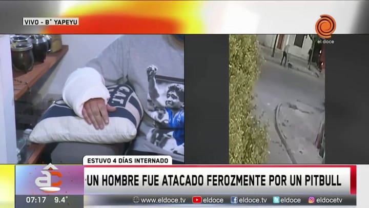 El escalofriante relato de un hombre que fue atacado por un pitbull - Fuente: eldoce