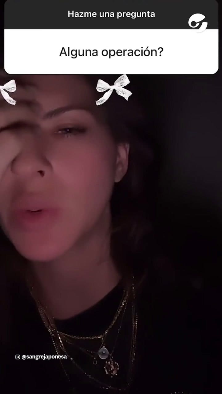 La China Suárez reveló que se operó las lolas