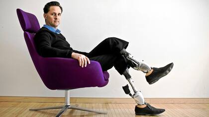 Hugh Herr tuvo un accidente cuando escalaba de joven y por eso perdió las extremidades