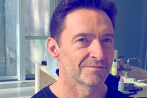 Hugh Jackman revela que los resultados de una biopsia de piel no son “concluyentes”