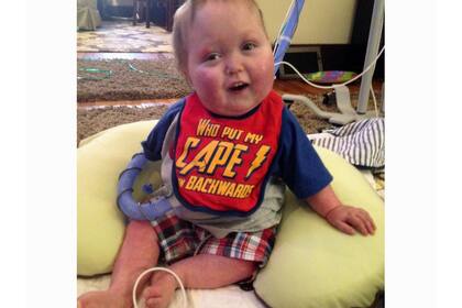 Ian Orbich, un de los niños a los que les injertaron la pieza hecha con la impresora 3D