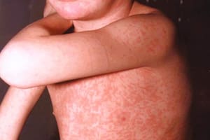 El mapa del recorrido que hizo la familia infectada a bordo de tres ómnibus de larga distancia