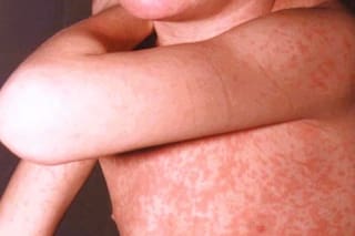 El dato sobre vacunación en la Argentina que encendió la alerta