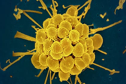 Imagen de las bacterias causantes de la gonorrea, obtenida con un microscopio electrónico.