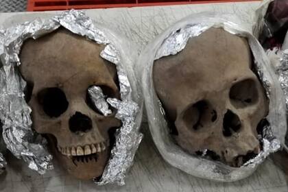 Imagen de los cráneos que fueron localizados en una paquetería en una ciudad mexicana