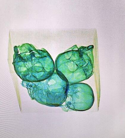 Imagen de los rayos x de los cuatro cráneos