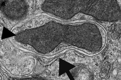 Imagen de microscopía electrónica de transmisión de una vesícula autofágica en el riñón de un ratón