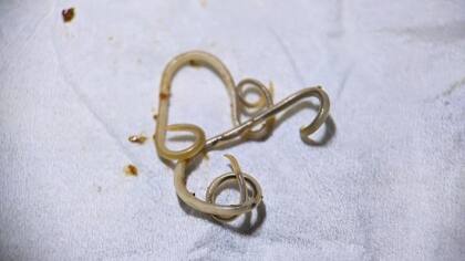 Imagen ilustrativa (Foto: iStock)