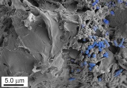 Imagen microscópica de microplásticos colonizados por la microbiota intestinal humana