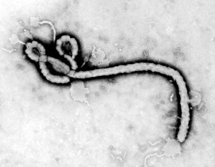 Primera imagen microscópica del virus del Ébola que obtuvo el virólogo de los CDC Frederick Murphy el 13 de octubre de 1976