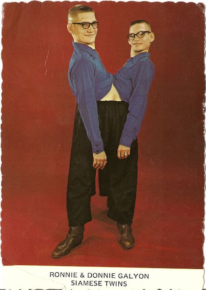 Imagen promocional de los siameses Galyon (Neil Davis)