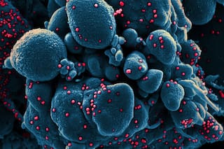 Covid: qué se sabe hasta ahora sobre la nueva cepa encontrada en Río de Janeiro