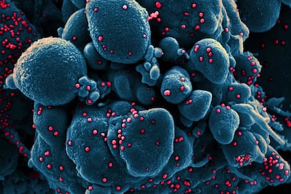 Imágenes de partículas dle coronavirus sobre una célula humana, tomadas con un microscopio electrónico y coloreadas en forma artificial