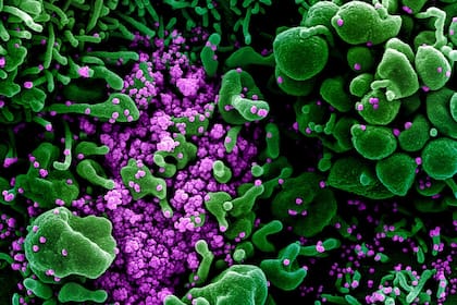 El mundo entero se encontró con el coronavirus casi sin esperarlo y desde ese momento, la ciencia comenzó con las investigaciones para hallar un tratamiento o una vacuna