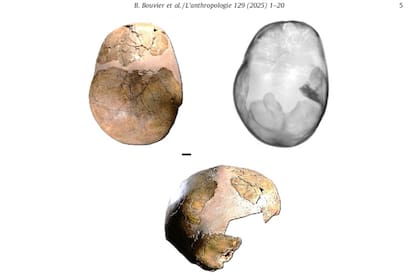 Imágenes del cráneo de Skhul I.